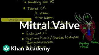 Mitral valve regurgitation and mitral valve prolapse | NCLEX-RN | Khan Academy