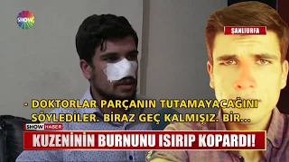 Kuzeninin burnunu ısırıp kopardı!