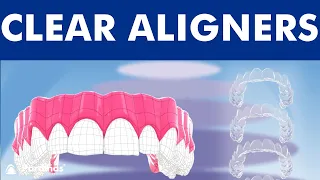 INVISALIGN - Orthodontic treatment with CLEAR ALIGNERS ©