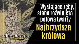 dawnotemu - Wystające zęby, słabo rozwinięta połowa twarzy - Najbrzydsza królowa