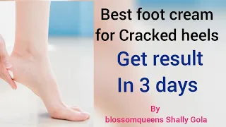 Best foot cream| Get Result in 3 days| Review of Feet up comfort overnight cream Oriflame |by Shally