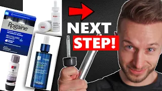 No Results with Topical Hair Regrowth Solution!? DO THIS ASAP! Minoxidil, Stemoxydine, Procapil