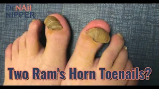 Ram's Horn Toenail, Are You Excited? (2020)