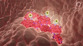 What is PSMA Theranostics, a ProsTIC, Peter Mac animation