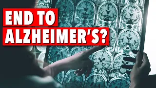 Dr. Dale Bredesen - The end of Alzheimer's - is it possible? | Ep108