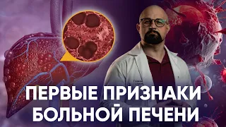 КАК ПОНЯТЬ, ЧТО ПЕЧЕНЬ УМИРАЕТ? АЛКОГОЛЬНЫЙ ЦИРРОЗ, ГЕПАТИТЫ, АСЦИТ. СИМПТОМЫ БОЛЕЗНЕЙ И ЛЕЧЕНИЕ.