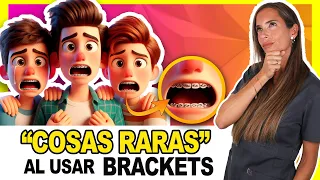 💡Si te han puesto BRACKETS (o te los pondrán) saber ESTO va A DEJARTE MUY TRANQUILO ,✋GARANTIZADO