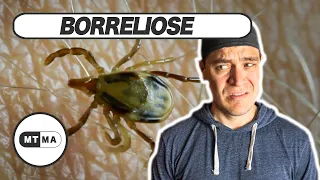 Lyme-Borreliose - Wie gefährlich ist das? Wie behandelt man das?