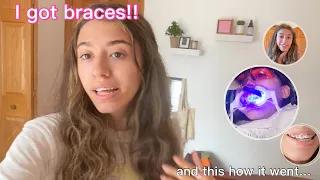 Getting braces vlog!! * vlogged what is was like for the first 24hrs with them*