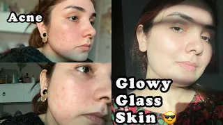 How i clear my acne - best Solution for glowy skin || Organic Glow