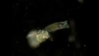 Wrotki (Rotifera) obserwowane w technice ciemnego pola - życie w kropli wody