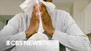 How allergies and weather changes could trigger a migraine