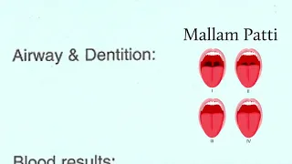 Preoperative anaesthetic assessment