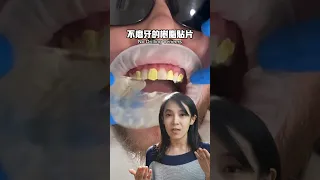 準新娘必看，快速且便宜擁有明星般笑容的方法#牙齒美白貼片