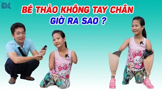 Cô bé không tay không chân giờ ra sao ? - ĐỘC LẠ BÌNH DƯƠNG