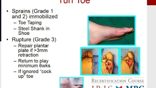 MILLER'S 2016 Orthopaedics:  Foot and Ankle