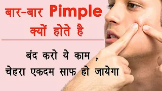 बार - बार पिंपल क्यों होते ? | Why do we get Pimple in Hindi | Beauty and Health Miracle