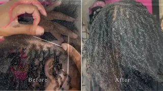 Microlocs Installation Tutorial | Microloc Extensions on Short Hair ft Exyhair