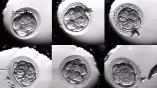 PHASEN EINER BEHANDLUNG IVF (In Vitro Befruchtung). Embryonenkultur