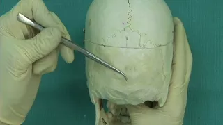 1.14 Step 7.  Cranial sutures