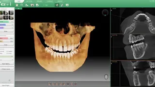 Vatech PAX I 3D SMART Panorama+Scan shot Cephalo +CBCT