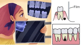 CT and CBCT basic understanding شرح مبسط لأشعة الأسنان ثلاثية الأبعاد  - أشعة الفم والوجه والفكين