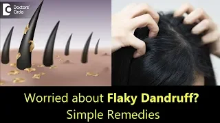 Thick flaky Dandruff  Causes, Prevention & Treatment - Dr. Rasya Dixit | Doctors' Circle