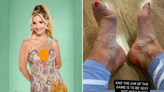 Helen Skelton left bloodied and bruised after brutal Strictly Come Dancing rehearsals