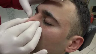 ASMR TURKISH BARBER + SKIN CARE + FACE CARE + MASK + FACE STEAM + RAZOR BEARD CUT + ASMR FOR SLEEP