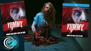 RLJE Films To Release Shudder Original ‘YUMMY’ On Blu-ray, DVD, And VOD