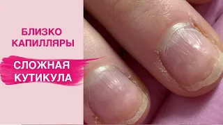 Difficult cuticle | What every manicurist fear