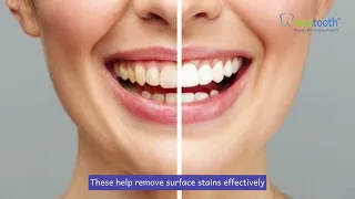 Shine Bright: Your Path to a Dazzling Smile | Realtooth Dental Clinic