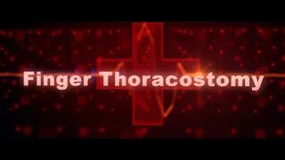 Finger Thoracostomy