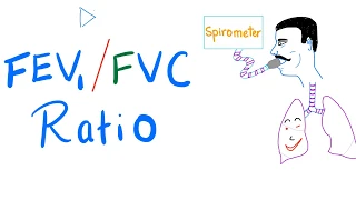 FEV1/FVC Ratio - Pulmonary Medicine - Obstructive VS Restrictive Lung Disease - Respiratory Physio