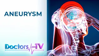 ANEURYSM: Causes, Symptoms, Treatment, and Prevention | DOCTORS on TV