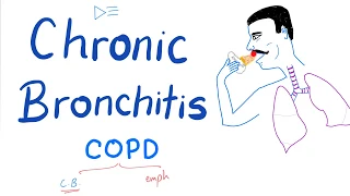 Chronic Bronchitis | COPD | Pulmonology Lectures