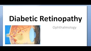 Ophthalmology 285 a Diabetic Retinopathy Diabetes effect on eye vision