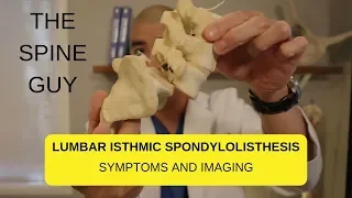 Lumbar Isthmic Spondylolisthesis - Part 1 -  Imaging and Symptoms