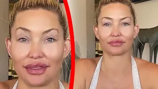 The Biggest Plastic Surgery Disasters In Hollywood