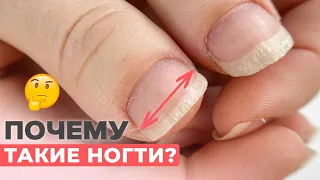 Как исправить такие широкие ногти? | Укрепление ногтей гелем