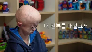 소아조로증 평균 수명을 훌쩍 넘긴 욘니의 고민