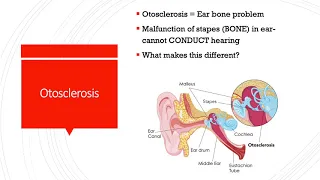 Med-Surg: Understanding Ear and Eye: The Basics