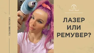 Лазер или ремувер - что выбрать?