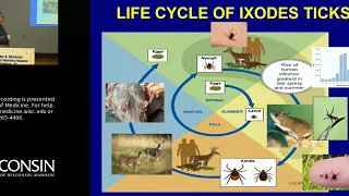 10/12/18: The Growing Global Threat of Tick-Borne Disease