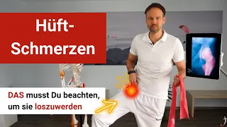 Hüftschmerzen ⚡ Warum sie nichts mit Deinem Hüftgelenk zu tun haben und viele Behandlungen scheitern