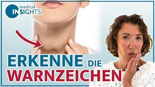 Schilddrüsenüberfunktion: Dos and Don'ts | Behandlung, Ernährung, Therapie | medical INSIGHTS