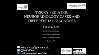 Tricky Pediatric Neuroradiology Cases and differential diagnosis: ESNR Webinars 2022 season finale.