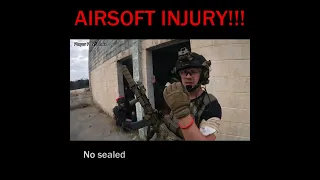 AIRSOFT PSA: WEAR PROTECTION! Or this happens...