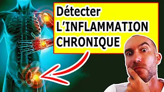 INFLAMMATION CHRONIQUE : 7 SYMPTÔMES Qui Montrent Que VOUS Êtes Concerné (+ LA SOLUTION)