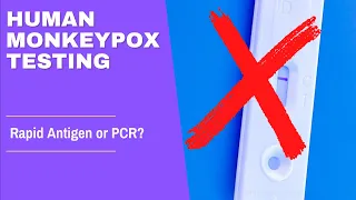 Monkeypox PCR testing? Are there rapid antigen tests for Monkeypox?